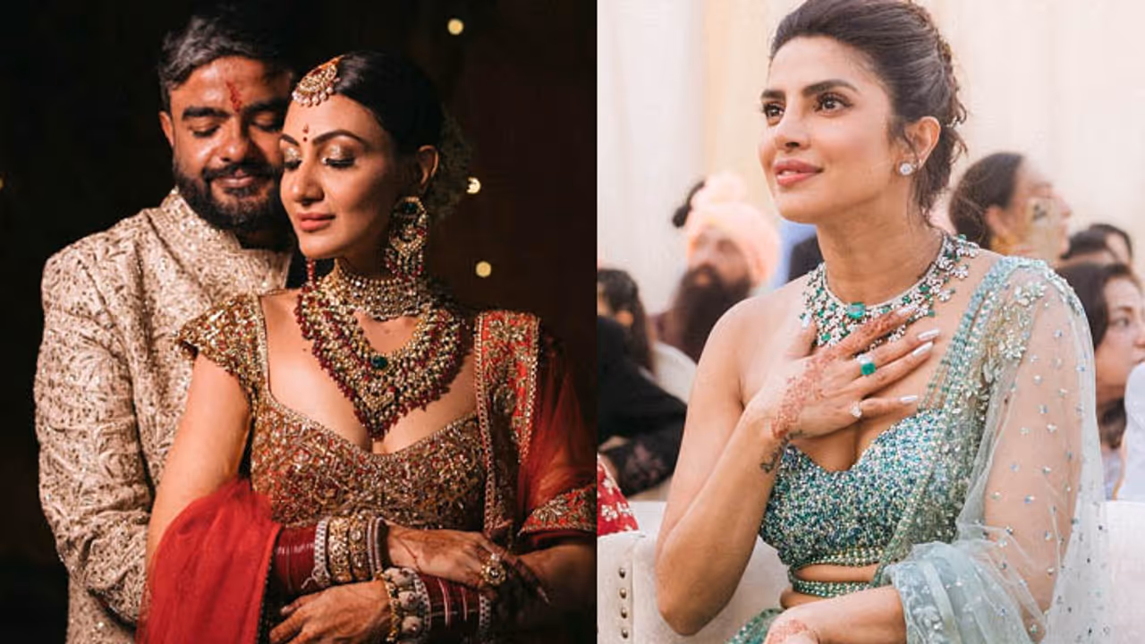 Priyanka Chopra Sister In Law Skin Allergy