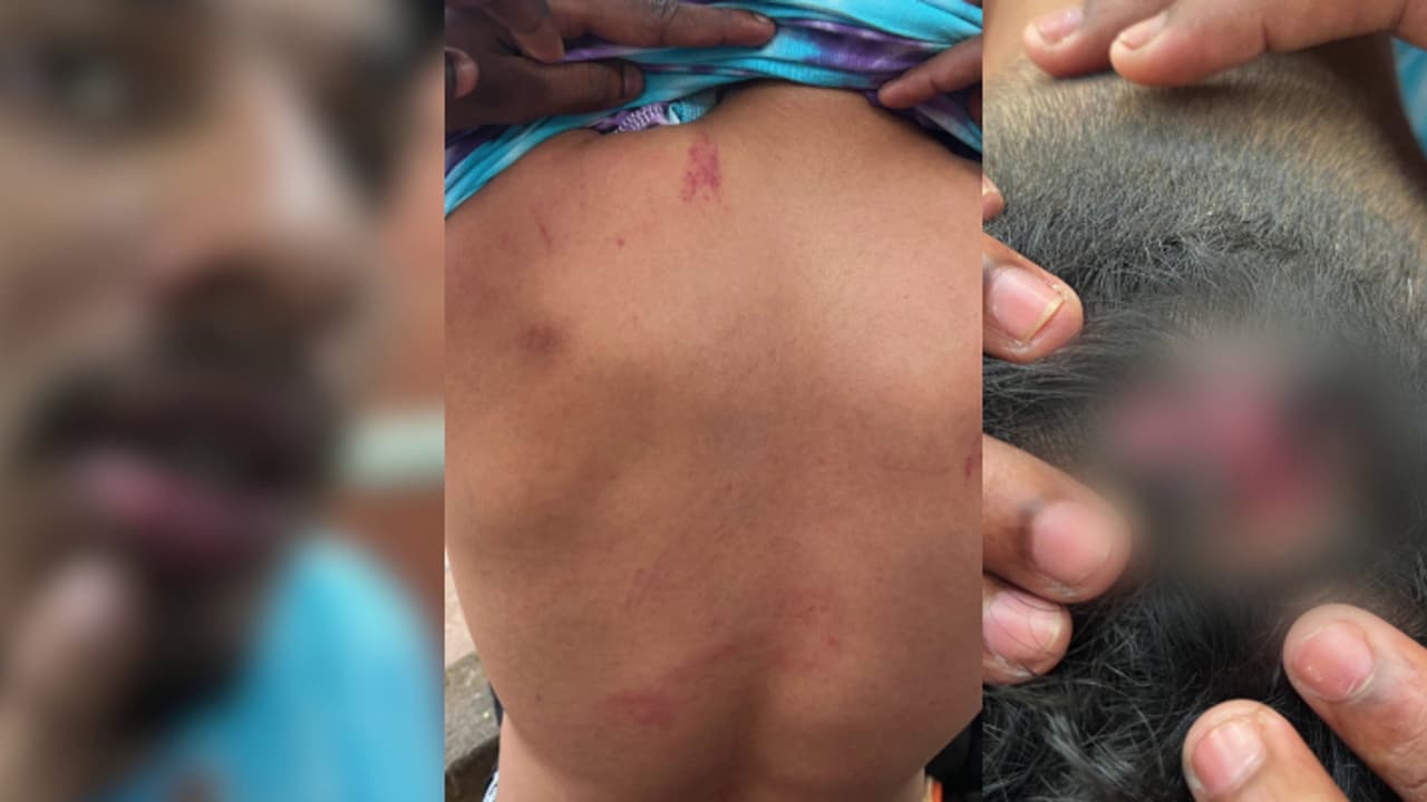 ഹോം സ്റ്റേ അടിച്ച് പൊളിച്ച് ഒന്നാം വർഷ വിദ്യാർത്ഥിക്ക് ക്രൂരമർദനം ; സീനിയർ നിയമ വിദ്യാർത്ഥികൾക്കെതിരെ കേസ്