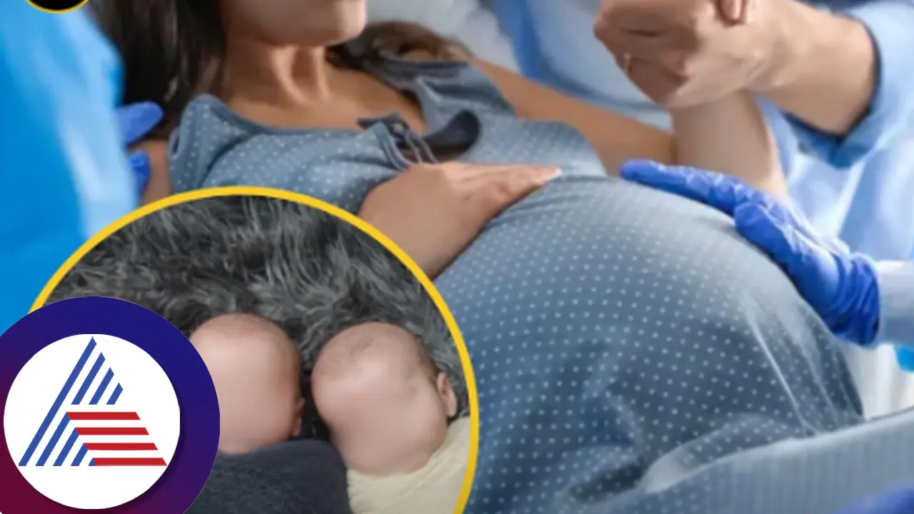 ಅವಳಿ ಮಕ್ಕಳು ಹುಟ್ಟಿದ ಬಳಿಕ ಹೊಲಿಗೆ ಹಾಕುವಾಗ್ಲೇ ಹೊಟ್ಟೆಯಲ್ಲಿತ್ತು ಮತ್ತೊಂದು ಮಗು! ಆಗಿದ್ದೇನು ನೋಡಿ! ಅವಳಿ ಮಕ್ಕಳು ಹುಟ್ಟಿದ ಬಳಿಕ ಹೊಲಿಗೆ ಹಾಕುವಾಗ್ಲೇ ಹೊಟ್ಟೆಯಲ್ಲಿತ್ತು ಮತ್ತೊಂದು ಮಗು! ಆಗಿದ್ದೇನು ನೋಡಿ!