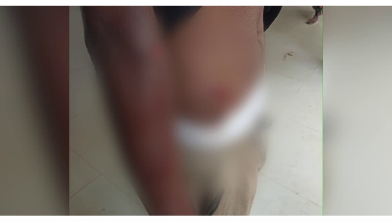 കാട്ടുപന്നി കുറുകെചാടി ബൈക്ക് നിയന്ത്രണം വിട്ട് മറിഞ്ഞ് അപകടം; 2 പേർക്ക് പരുക്കേറ്റു കാട്ടുപന്നി കുറുകെചാടി ബൈക്ക് നിയന്ത്രണം വിട്ട് മറിഞ്ഞ് അപകടം; 2 പേർക്ക് പരുക്കേറ്റു