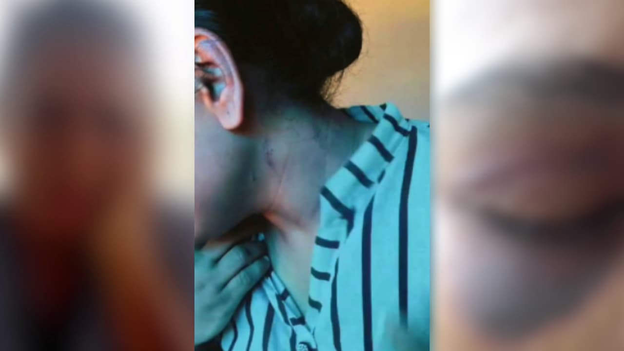 യുവതിയെ വീട്ടിൽ പൂട്ടിയിട്ടു, കഴുത്തിൽ ബെൽറ്റിട്ട് മുറുക്കി ക്രൂര മർദനം; ഭർത്താവിനും ഭർതൃമാതാവിനുമെതിരെ കേസ്