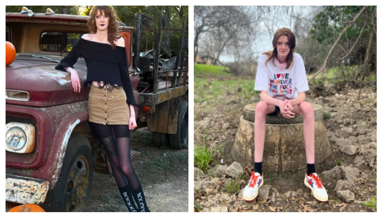 'വസ്‌ത്രങ്ങൾ പാകമാകുന്നില്ല, സങ്കടം തോന്നാറുണ്ട്'; ലോകത്തെ നീളമേറിയ കാലുകൾ ഉള്ള മാകി കുറിൻ പറയുന്നൂ 