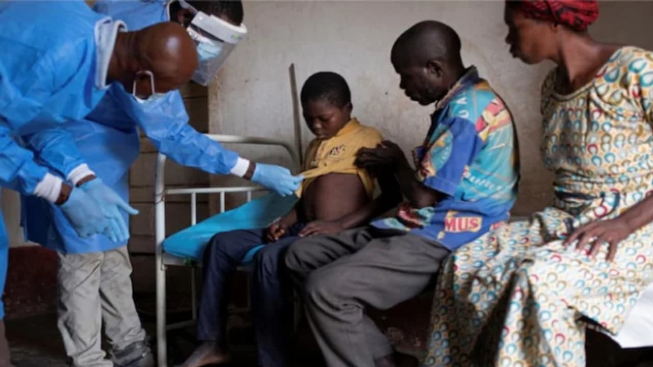 ആഴ്ചകൾക്കുള്ളിൽ 431 പേർക്ക് അജ്ഞാത രോഗബാധ, 53 പേർ മരിച്ചത് 2 ദിവസത്തിനകം; കോംഗോയിൽ ആശങ്കയെന്ന് ലോകാരോഗ്യ സംഘടന