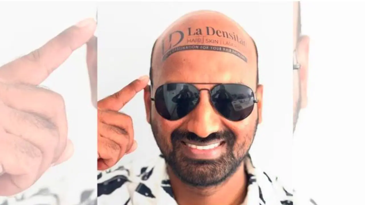 ಬೋಳು ತಲೆಯಿಂದ ಬಾಳು ಬೆಳಕಾಯ್ತು: ತಲೆಯಲ್ಲೇ ಜಾಹೀರಾತಿಗೆ ಜಾಗ ಕೊಟ್ಟ ಕೇರಳ ಯುವಕ ಬೋಳು ತಲೆಯಿಂದ ಬಾಳು ಬೆಳಕಾಯ್ತು: ತಲೆಯಲ್ಲೇ ಜಾಹೀರಾತಿಗೆ ಜಾಗ ಕೊಟ್ಟ ಕೇರಳ ಯುವಕ