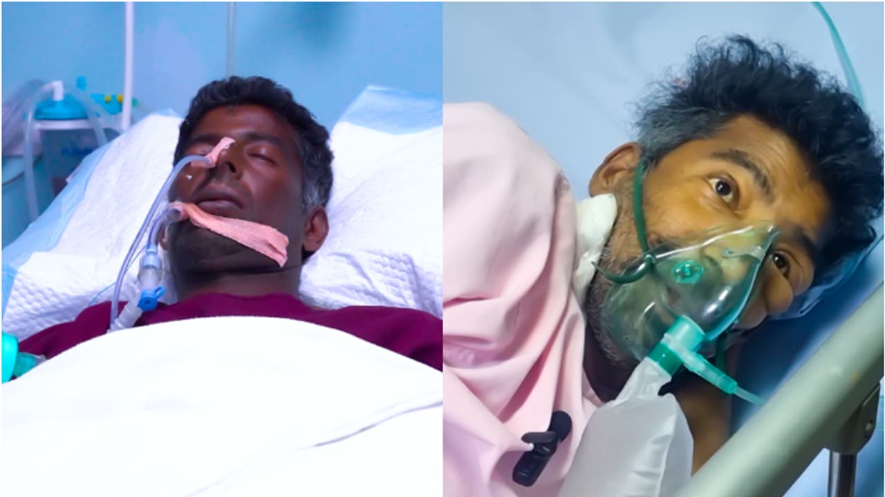 ആശുപത്രി ബിൽ 68 ലക്ഷം, ഔട്ട് പാസ്സ് കാലാവധി തീരാൻ രണ്ട് മാസം കൂടി; നാട്ടിലെത്താൻ കനിവ് തേടി മഹേഷ് 