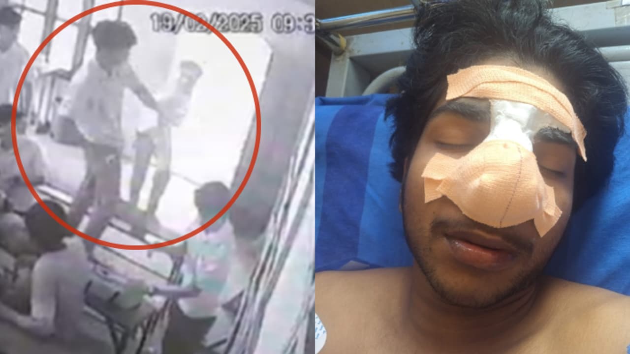 ഒറ്റപ്പാലത്തെ സ്വകാര്യ ഐടിഐയിൽ സഹപാഠിയുടെ മർദ്ദനമേറ്റ് വിദ്യാർത്ഥിയുടെ മൂക്കിൻ്റെ എല്ല് പൊട്ടി; പൊലീസ് കേസ്