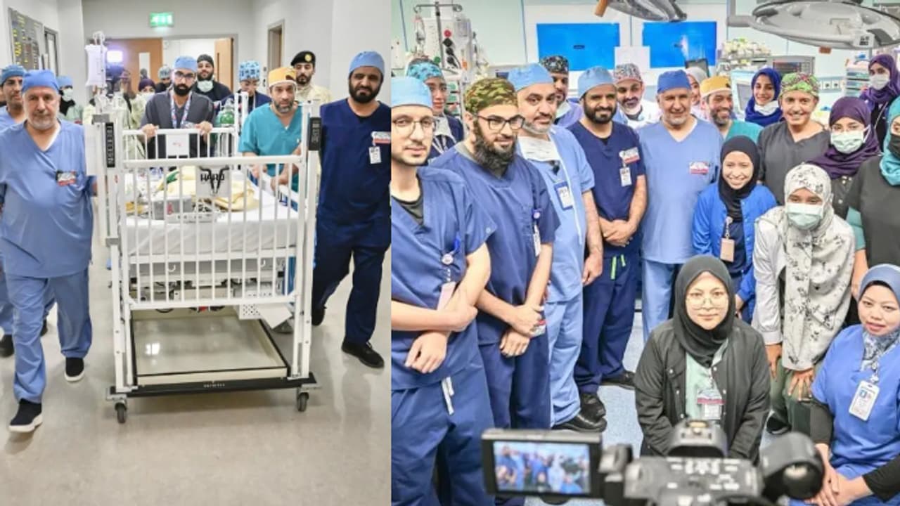 അഞ്ച് ഘട്ടങ്ങളായി 8 മണിക്കൂറോളം നീണ്ട ശസ്ത്രക്രിയ; 17 മാസം പ്രായമുള്ള ഹവ്വക്കും ഖദീജക്കും ഇനി രണ്ടു ജീവിതം