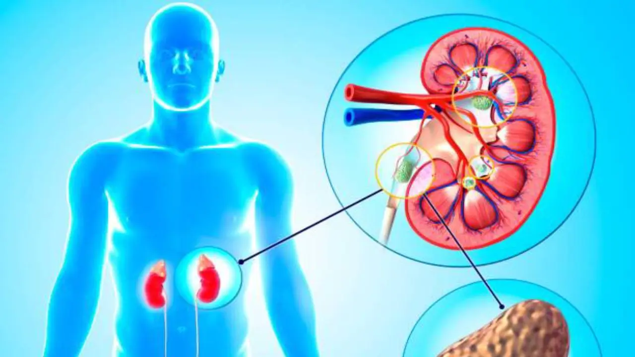 கிட்னி ஸ்டோன் இருப்பதை ஆரம்பத்திலேயே தெரிந்து கொள்ள அறிகுறிகள்