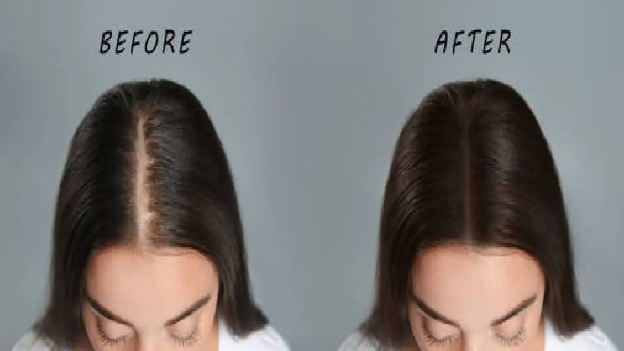 hair groth hair groth