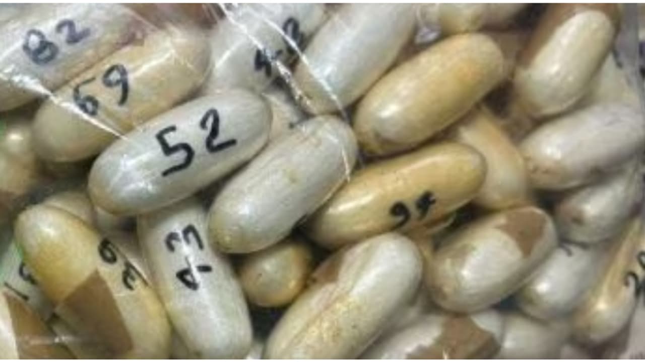 വിമാനമിറങ്ങിയ യാത്രക്കാരിയെ സംശയം; ആശുപത്രിയിലെത്തിച്ച് പരിശോധിച്ചപ്പോൾ 100 കൊക്കെയ്ൻ കാപ്സ്യൂൾ, വില 11 കോടി വിമാനമിറങ്ങിയ യാത്രക്കാരിയെ സംശയം; ആശുപത്രിയിലെത്തിച്ച് പരിശോധിച്ചപ്പോൾ 100 കൊക്കെയ്ൻ കാപ്സ്യൂൾ, വില 11 കോടി