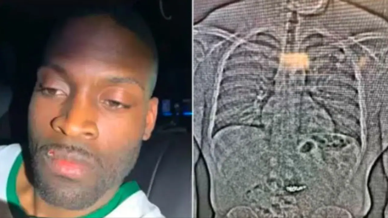 ದರೋಡೆ ಆರೋಪಿಗೆ ಸ್ಕ್ಯಾನ್ ಮಾಡಿದ ಪೊಲೀಸರಿಗೆ ಶಾಕ್: ಒಳಗಿದ್ದಿದ್ದು ಒಂದೆರಡು ಕೋಟಿ ಮೌಲ್ಯದ್ದಲ್ಲ..! ದರೋಡೆ ಆರೋಪಿಗೆ ಸ್ಕ್ಯಾನ್ ಮಾಡಿದ ಪೊಲೀಸರಿಗೆ ಶಾಕ್: ಒಳಗಿದ್ದಿದ್ದು ಒಂದೆರಡು ಕೋಟಿ ಮೌಲ್ಯದ್ದಲ್ಲ..!