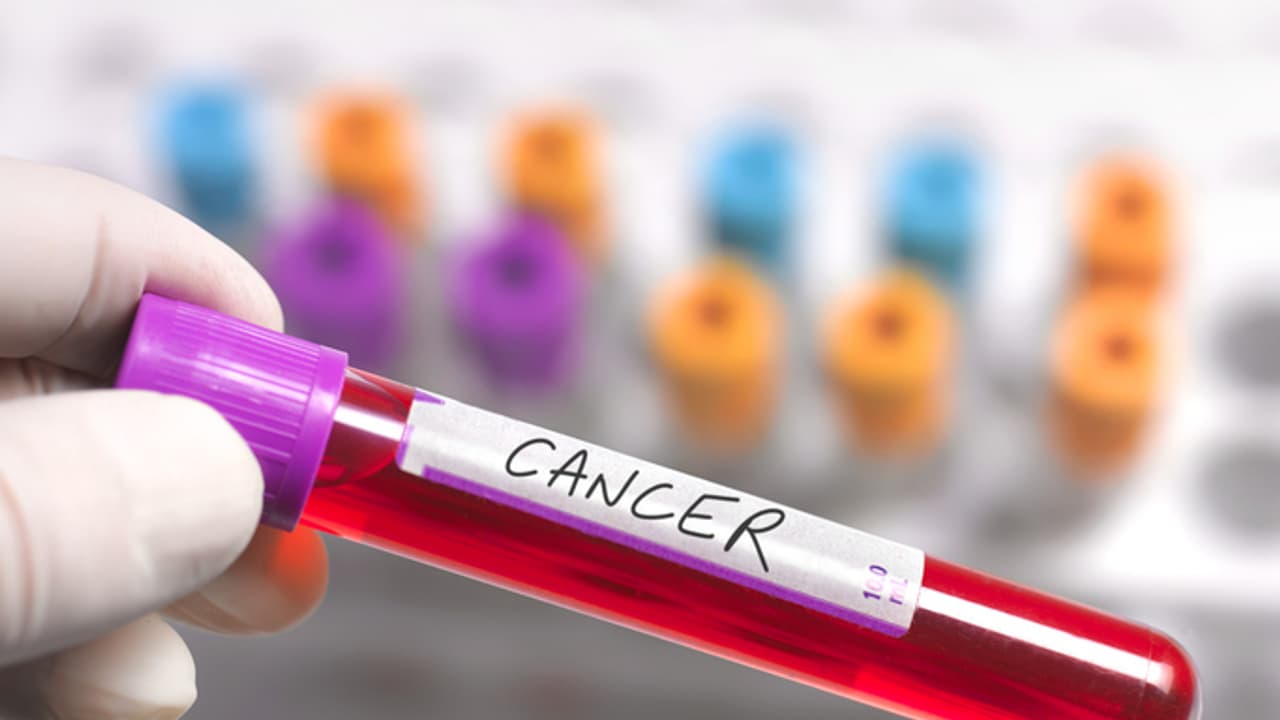 ഇനിയും പരിശോധിച്ചില്ലേ? തുടക്കത്തിൽ അറിഞ്ഞാൽ ചികിത്സിച്ച് മാറ്റാം; 10 ലക്ഷം സ്ക്രീനിങ്ങിൽ 86 പേര്‍ക്ക് കാൻസർ