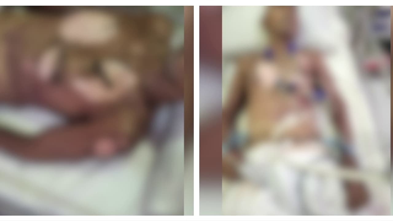 കാസർകോട് ബന്ധുവീട്ടിലേക്ക് നടന്നുപോയ വയോധികൻ സൂര്യാഘാതമേറ്റ് മരിച്ചു