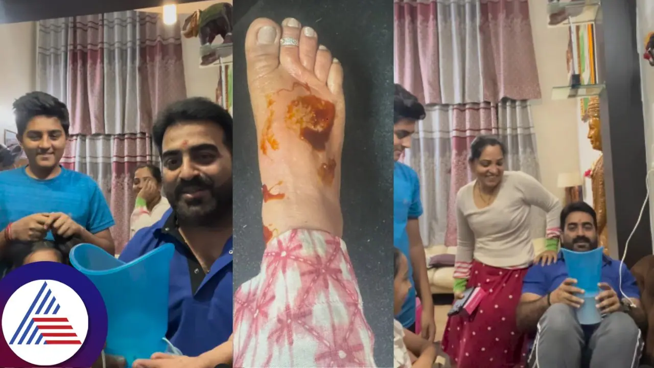 ಕಾಲು ಸುಟ್ಟಿಕೊಂಡು ಹಾಸಿಗೆ ಹಿಡಿದ ಹೆಂಡತಿ ; ಎಡವಟ್ಟಿನ ಬಗ್ಗೆ ಕ್ಲಾರಿಟಿ ಕೊಟ್ಟ ಮಾಸ್ಟರ್ ಆನಂದ್