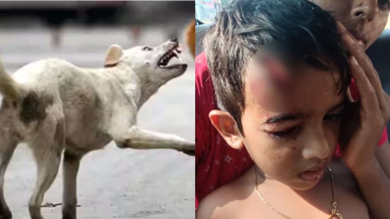 വീട്ടുമുറ്റത്ത് കളിച്ചുകൊണ്ടിരുന്ന അഞ്ചു വയസുകാരിക്ക് നേരെ തെരുവ് നായയുടെ ആക്രമണം വീട്ടുമുറ്റത്ത് കളിച്ചുകൊണ്ടിരുന്ന അഞ്ചു വയസുകാരിക്ക് നേരെ തെരുവ് നായയുടെ ആക്രമണം
