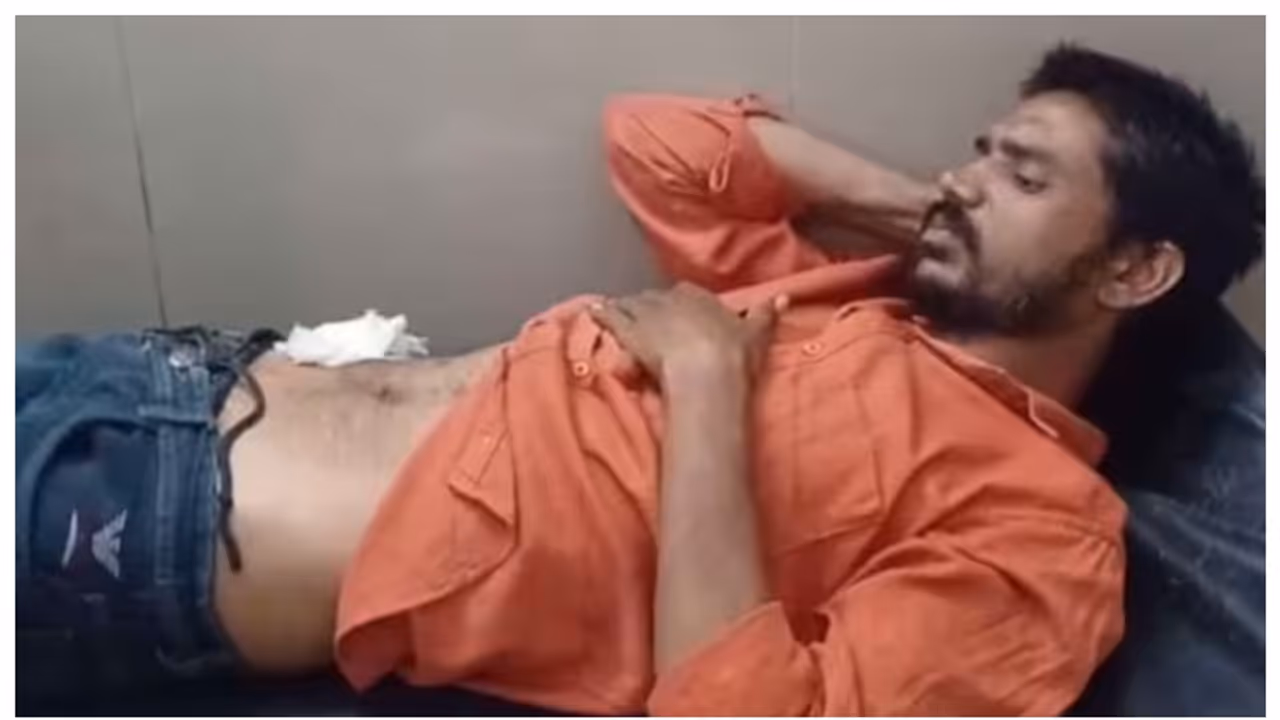 വയറ് വേദന അസഹനീയം, യൂട്യൂബ് നോക്കി സ്വയം ശസ്ത്രക്രിയ നടത്തിയ യുവാവ് ആശുപത്രിയില്‍, 11 തുന്നിക്കെട്ട് 