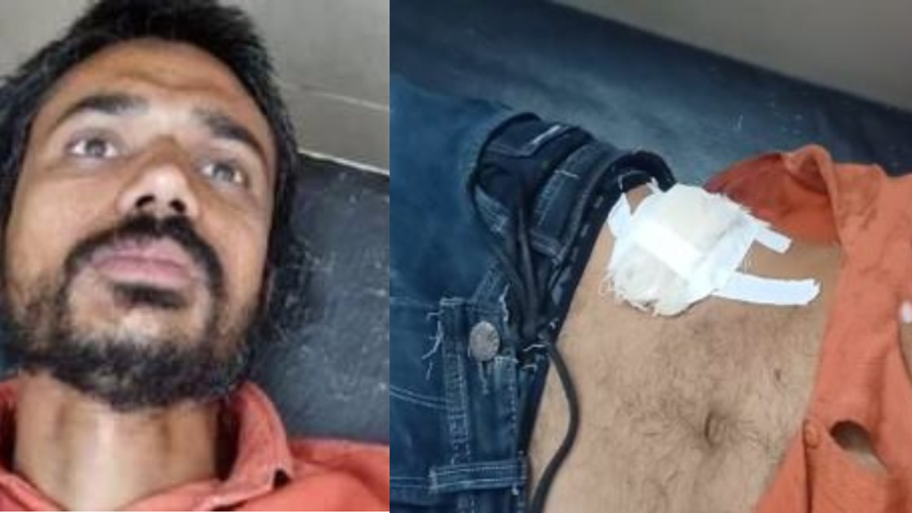 shocking up news man performs own surgery after watching youtube