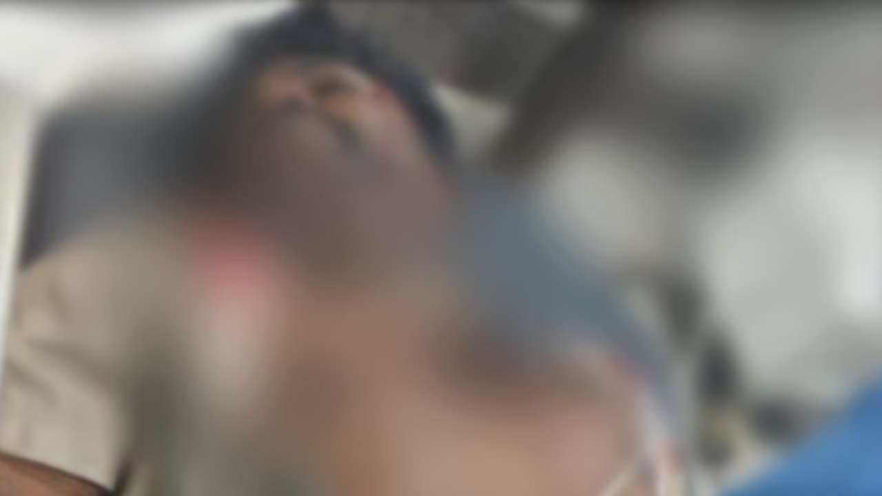 തിരുവനന്തപുരത്ത് ഡിവൈഎഫ്ഐ നേതാവിന് കുത്തേറ്റു; ഒരാൾ കസ്റ്റഡിയിൽ തിരുവനന്തപുരത്ത് ഡിവൈഎഫ്ഐ നേതാവിന് കുത്തേറ്റു; ഒരാൾ കസ്റ്റഡിയിൽ