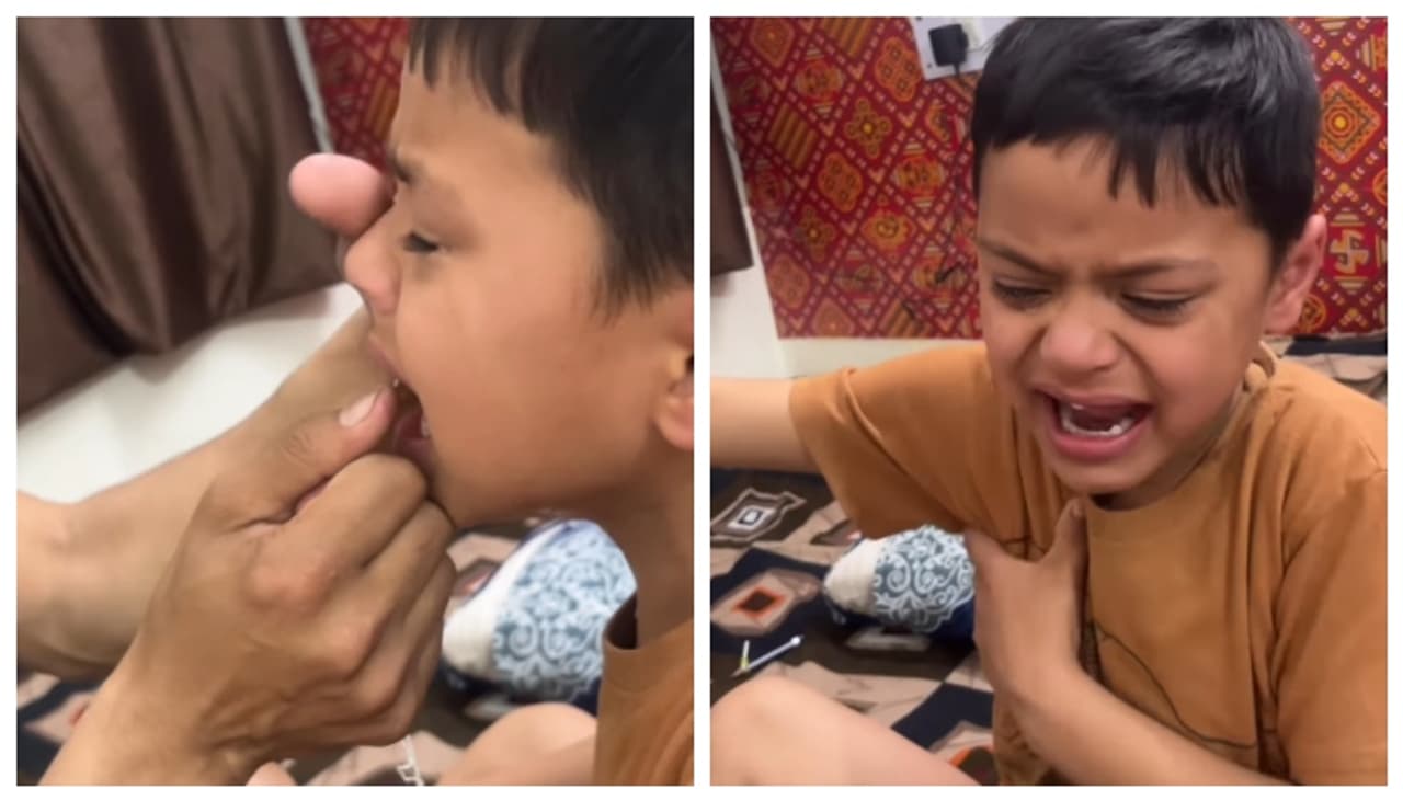 അച്ഛൻ തന്‍റെ പല്ല് പറിച്ചതിന് പിന്നാലെ നെഞ്ചത്തടിച്ച് 'ഞാൻ ശക്തനായ ആൺകുട്ടിയാണെന്ന് കരഞ്ഞ് പറയുന്ന മകൻ; വീഡിയോ