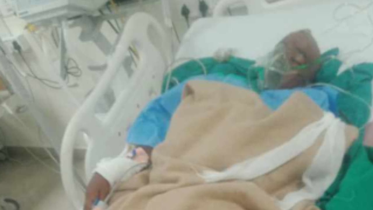 മുളവടികൊണ്ട് ആറാം ക്ലാസുകാരന്‍റെ തലക്കടിച്ചു; അധ്യാപകന്‍റെ ക്രൂര മർദനം, ദളിത്‌ വിദ്യാർഥിയുടെ തലയോട്ടി തകർന്നു