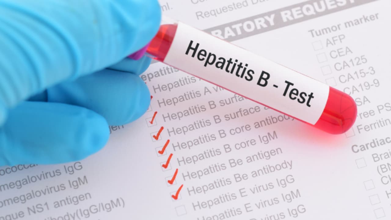 കുവൈത്തിൽ പകർച്ചവ്യാധി വൈദ്യപരിശോധനയ്ക്ക് വിധേയരാകുന്നത് പ്രതിവർഷം 5 ലക്ഷത്തിലധികം പ്രവാസികൾ 