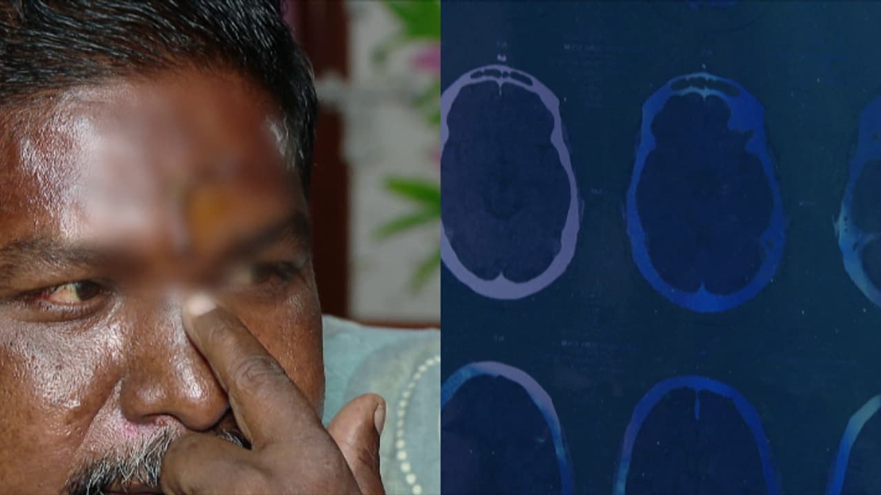 തുന്നിക്കെട്ടിയ മുറിവിനുള്ളിൽ ഉറുമ്പുകളെ കണ്ടെത്തിയ സംഭവം; ആഭ്യന്തര അന്വേഷണം തുടങ്ങി ആരോഗ്യവകുപ്പ്