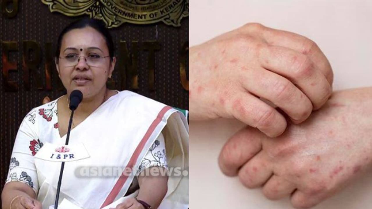 റീയൂണിയന് ദ്വീപുകളില് ചിക്കന്ഗുനിയ വ്യാപനം, കേരളം കരുതിയിരിക്കണം; ആരോഗ്യ മന്ത്രി വീണാ ജോര്ജ് റീയൂണിയന് ദ്വീപുകളില് ചിക്കന്ഗുനിയ വ്യാപനം, കേരളം കരുതിയിരിക്കണം; ആരോഗ്യ മന്ത്രി വീണാ ജോര്ജ്