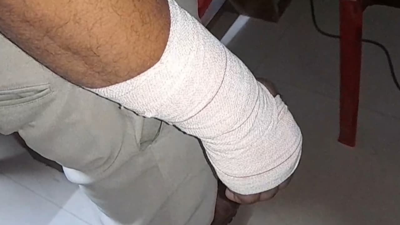 പ്രതിയെ പിടികൂടുന്നതിനിടയിൽ പൊലീസിന് നേരെ ആക്രമണം; കുറത്തിക്കാട് എസ്ഐ ഉദയകുമാറിന് കൈക്ക് പരുക്കേറ്റു