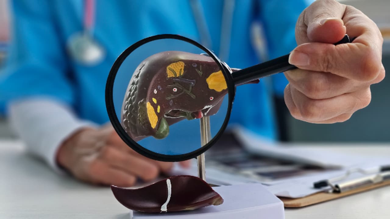 World Liver Day 2025: കരളിനെ ബാധിക്കുന്ന നാല് രോഗങ്ങളെ കുറിച്ചറിയാം