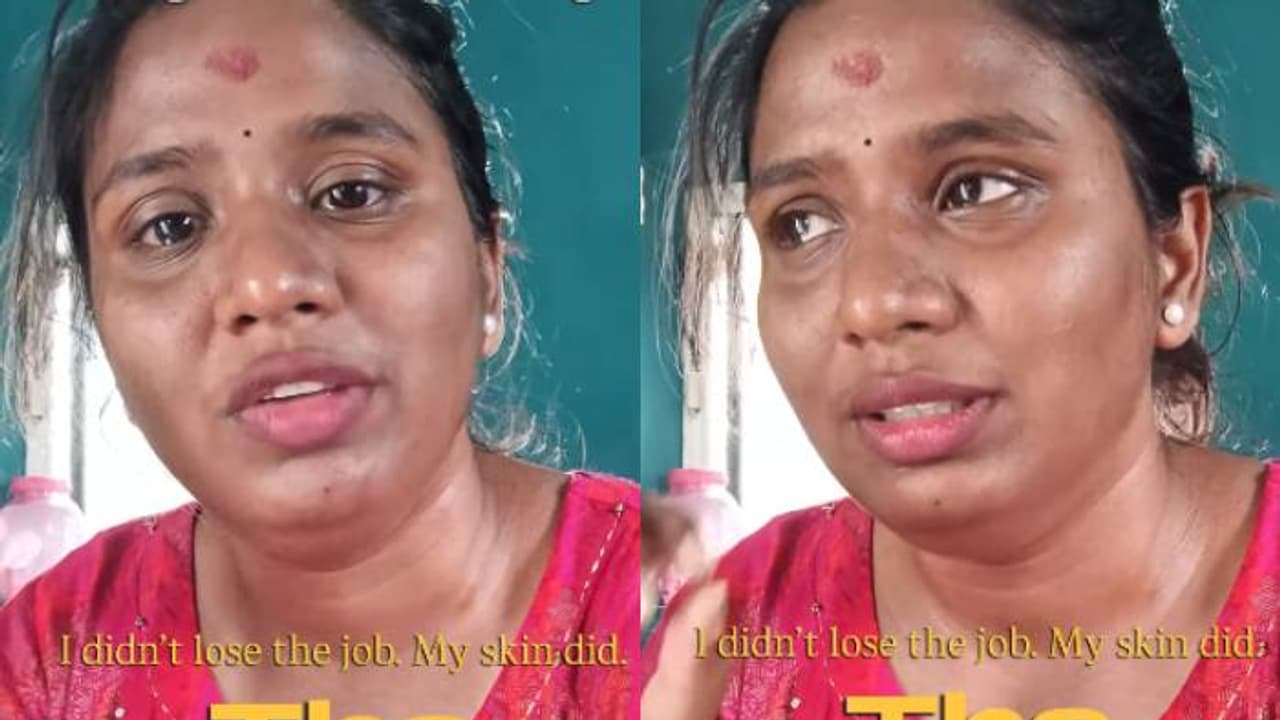 നിറം കാരണം ജോലി കിട്ടിയില്ല, കുട്ടിക്കാലം തൊട്ട് അനുഭവിക്കുന്ന വിവേചനം, വീഡിയോയുമായി യുവതി 