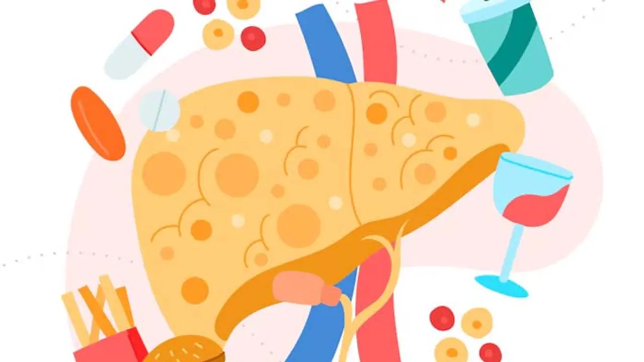 Liver Health: ಸ್ವತಃ ವೈದ್ಯರೇ ಈ ಮೂರು ಆಹಾರಗಳಿಂದ ದೂರವಿರುತ್ತಾರೆ! 