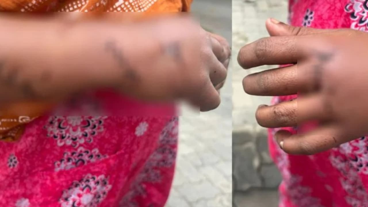 ലഹരി സംഘത്തില് നിന്ന് പിന്മാറിയതിന് വധഭീഷണി, പരാതി നല്കിയതിന് പിന്നാലെ കോഴിക്കോട് യുവതിക്ക് നേരെ ആക്രമണം ലഹരി സംഘത്തില് നിന്ന് പിന്മാറിയതിന് വധഭീഷണി, പരാതി നല്കിയതിന് പിന്നാലെ കോഴിക്കോട് യുവതിക്ക് നേരെ ആക്രമണം