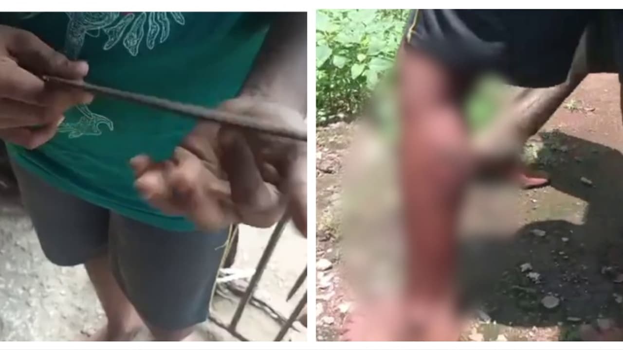 കൂട്ടുകാരുടെ കൂടെ കളിക്കാൻ പോയി, 11കാരനെ ഇരുമ്പ് കമ്പി ചൂടാക്കി പൊള്ളിച്ച് അച്ഛൻ; അറസ്റ്റിൽ കൂട്ടുകാരുടെ കൂടെ കളിക്കാൻ പോയി, 11കാരനെ ഇരുമ്പ് കമ്പി ചൂടാക്കി പൊള്ളിച്ച് അച്ഛൻ; അറസ്റ്റിൽ