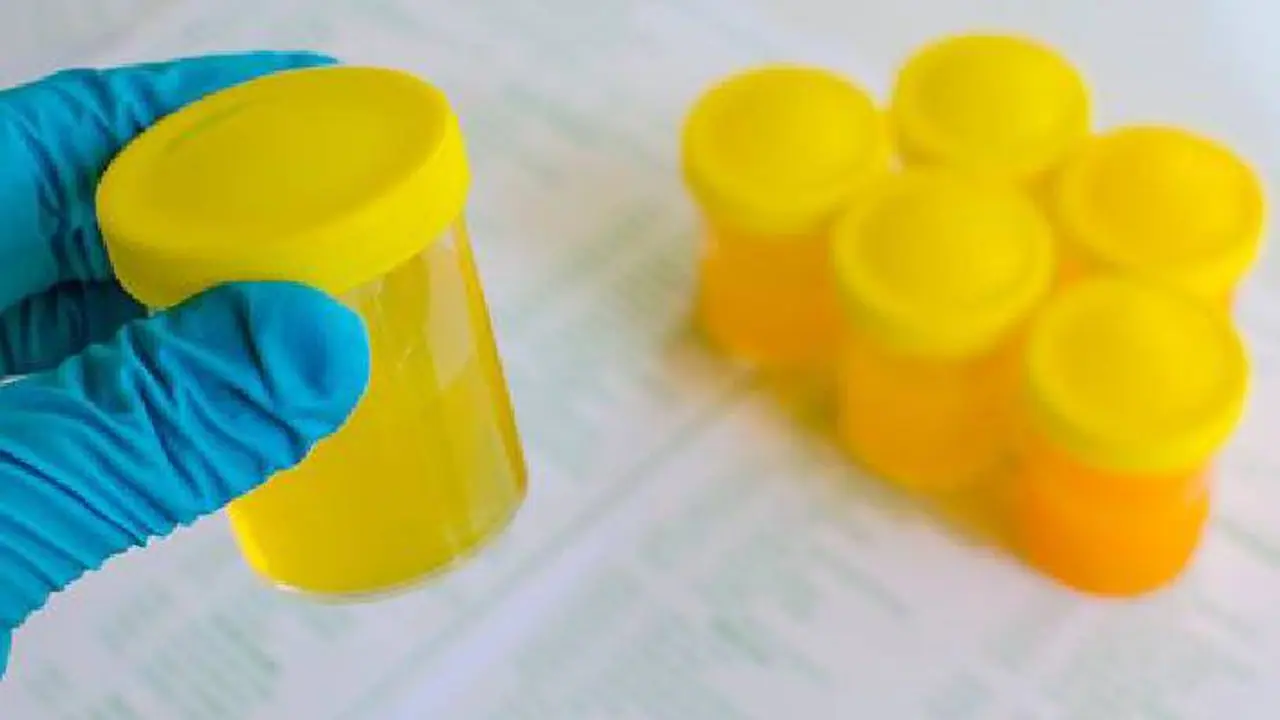 urine therapy urine therapy