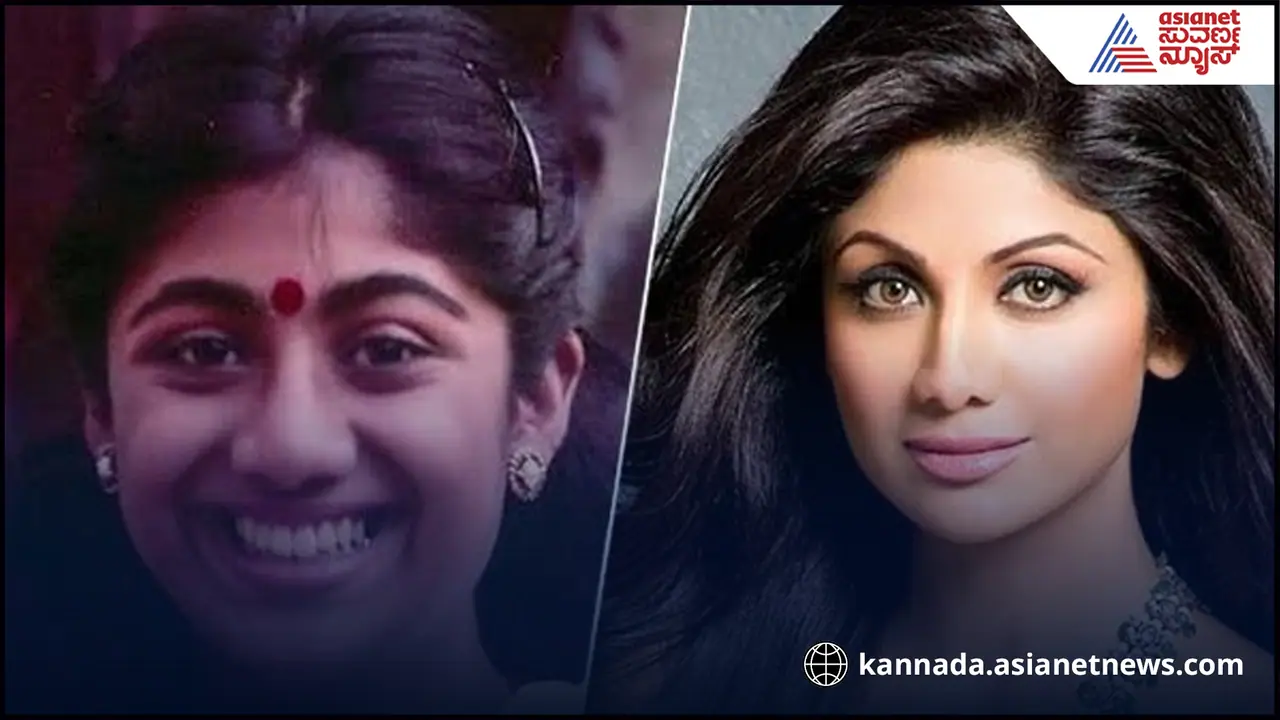 ಯೌವನಕ್ಕಿಂತ ವಯಸ್ಸಾದ್ಮೇಲೆ ಶಿಲ್ಪಾ ಶೆಟ್ಟಿ ಸುಂದ್ರಿಯಾಗಲು ಕಾರಣ ಕೊನೆಗೂ ರಿವೀಲ್​! 