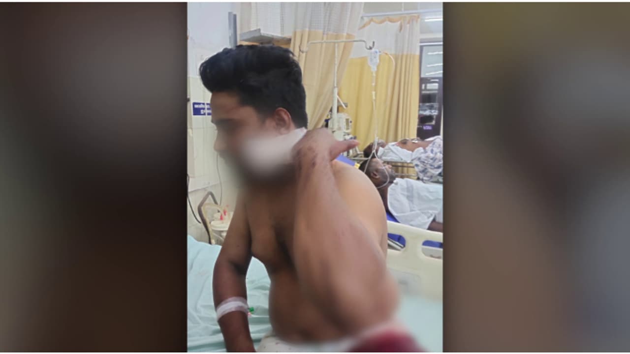 കോഴിക്കോട് പന്നിയങ്കരയിൽ കല്യാണ വീട്ടിൽ മദ്യത്തെ ചൊല്ലി തർക്കം; ഒരാൾക്ക് കുത്തേറ്റു, ആശുപത്രിയിൽ ചികിത്സയിൽ