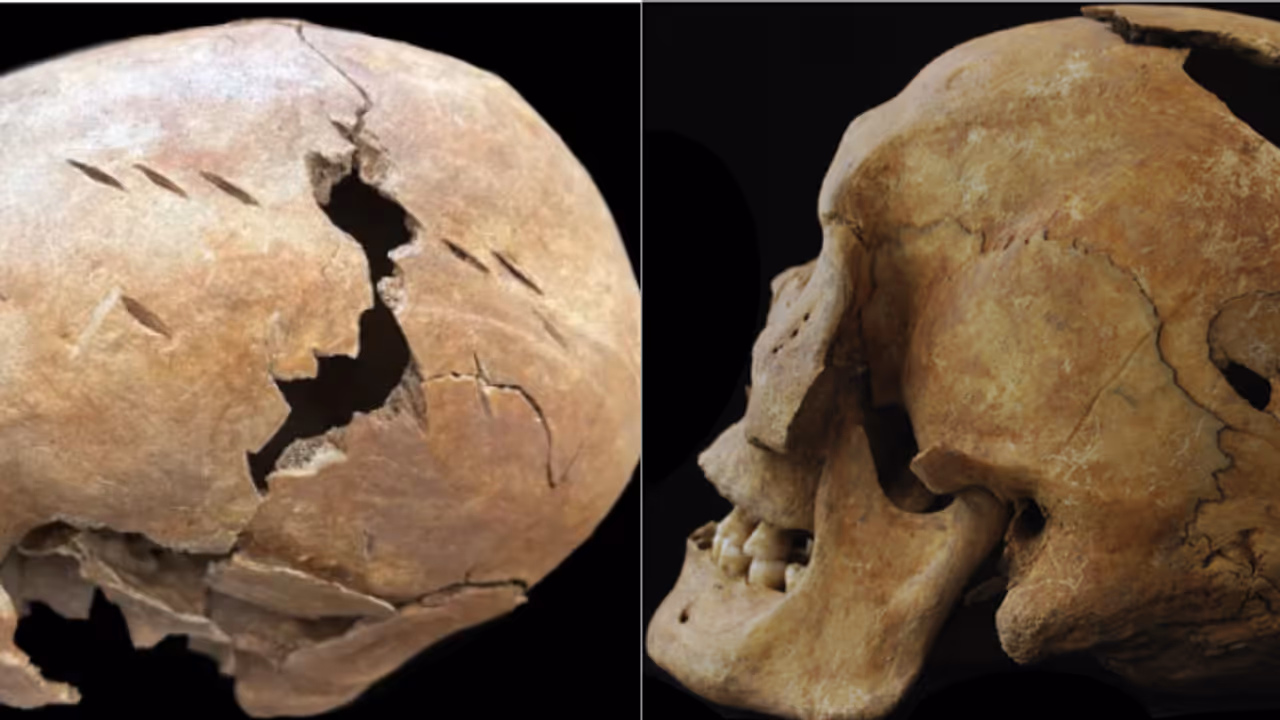 തലയോട്ടിയിൽ 18 മുറിവുകൾ, തുളയിട്ടത് പോലെയുള്ള കാലുകൾ! പുരാതന ചൈനയിലെ അസ്ഥികൂടങ്ങൾ കണ്ട് ഗവേഷകർ ഞെട്ടി