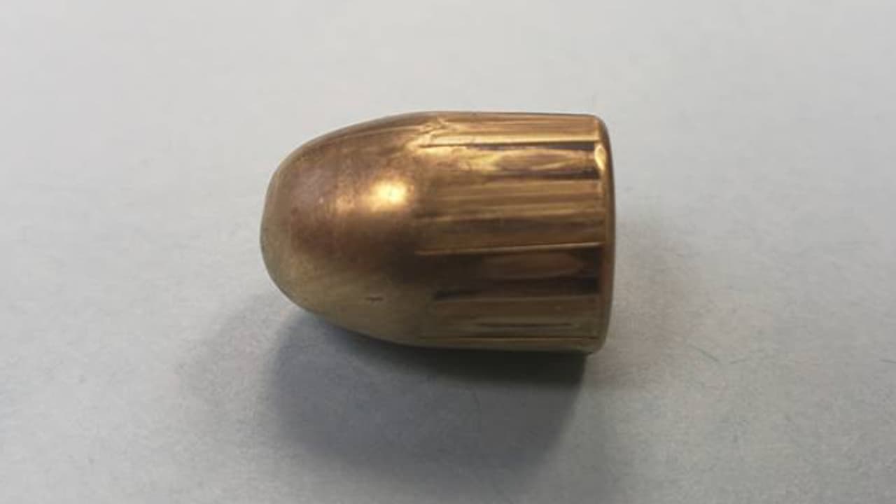 കമ്പി കൊണ്ട് പരിക്കേറ്റതാണെന്ന് പറഞ്ഞ് യുവാവ് ആശുപത്രിയിൽ; സ്കാനിംഗിൽ കണ്ടത് വെടിയുണ്ട, സംഭവം വയനാട്ടിൽ കമ്പി കൊണ്ട് പരിക്കേറ്റതാണെന്ന് പറഞ്ഞ് യുവാവ് ആശുപത്രിയിൽ; സ്കാനിംഗിൽ കണ്ടത് വെടിയുണ്ട, സംഭവം വയനാട്ടിൽ