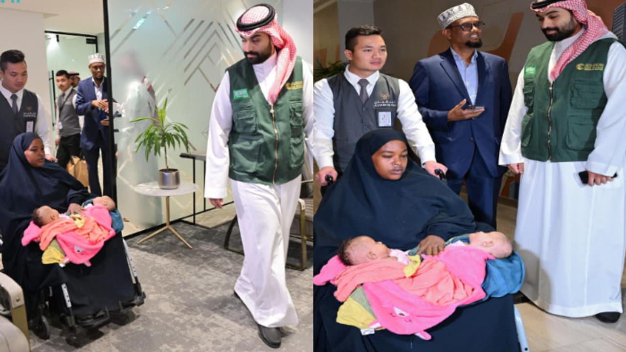 വേർപെടാൻ കൊതിച്ച് സയാമീസ് ഇരട്ടകളായ റഹ്മയും റംലയും, ശസ്ത്രക്രിയക്കായി റിയാദിലെത്തി വേർപെടാൻ കൊതിച്ച് സയാമീസ് ഇരട്ടകളായ റഹ്മയും റംലയും, ശസ്ത്രക്രിയക്കായി റിയാദിലെത്തി