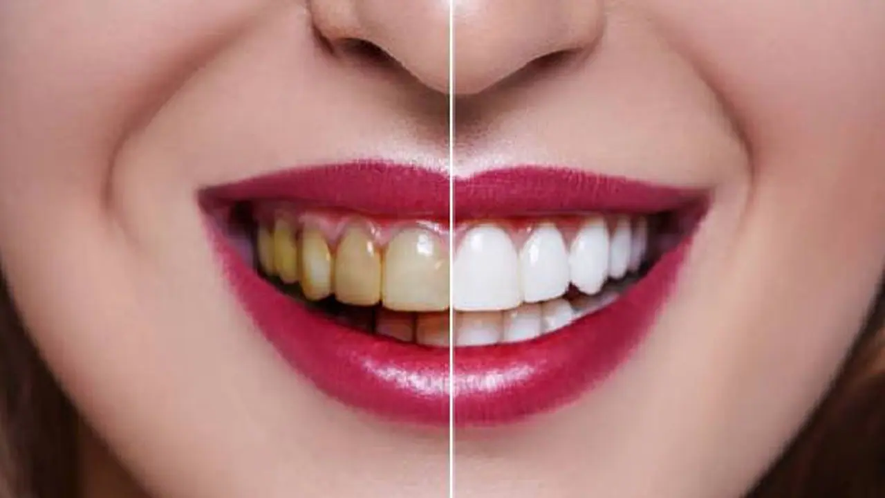 teeth