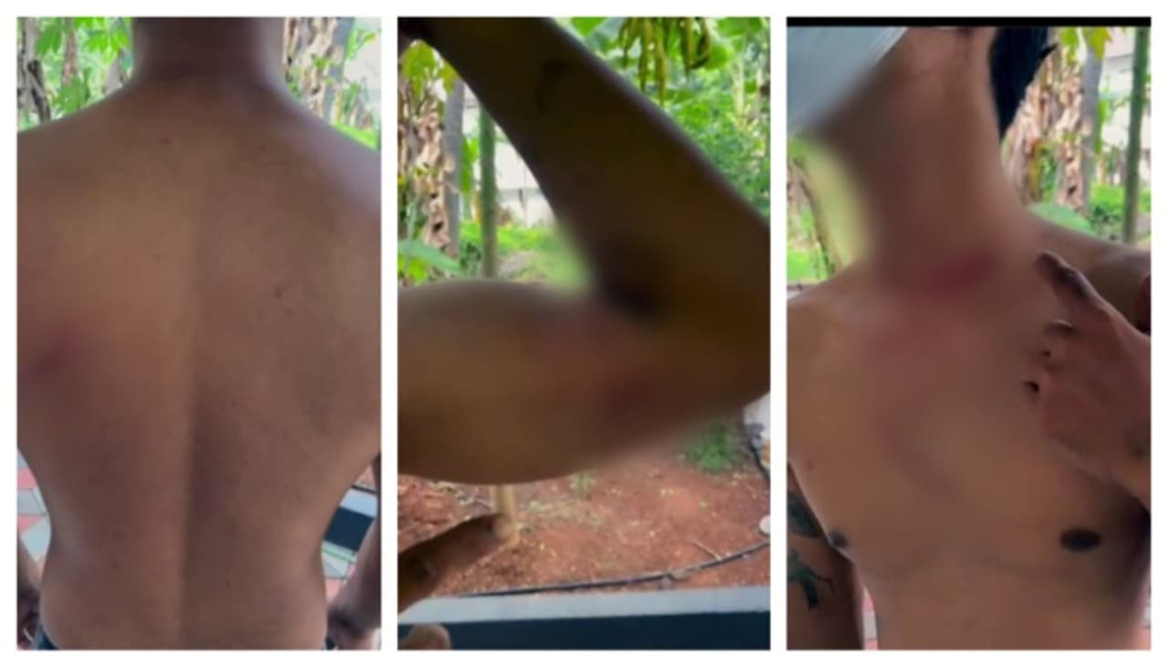 മൂത്രമൊഴിക്കാൻ ബസ് നിർത്താനാവശ്യപ്പെട്ടു; യാത്രക്കാരനെ ക്രൂരമായി മർദിച്ച് ടൂറിസ്റ്റ് ബസ് ക്ലീനർ; അറസ്റ്റിൽ 