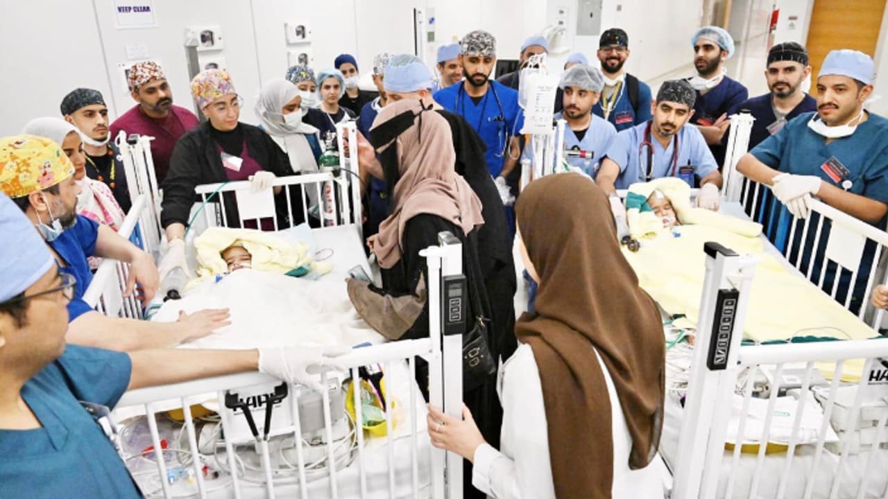 പതിനഞ്ചര മണിക്കൂർ നീണ്ട ശസ്ത്രക്രിയ, എരിത്രിയൻ സയാമീസ് ഇരട്ടകളെ റിയാദിൽ വേർപ്പെടുത്തി 