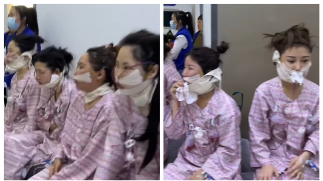 'ഹൊറർ സിനിമയിലെ രംഗമല്ല, കോസ്മെറ്റിക് സ‍ർജറി കഴിഞ്ഞ സ്ത്രീകളാണ് അവർ'; വീഡിയോ വൈറൽ