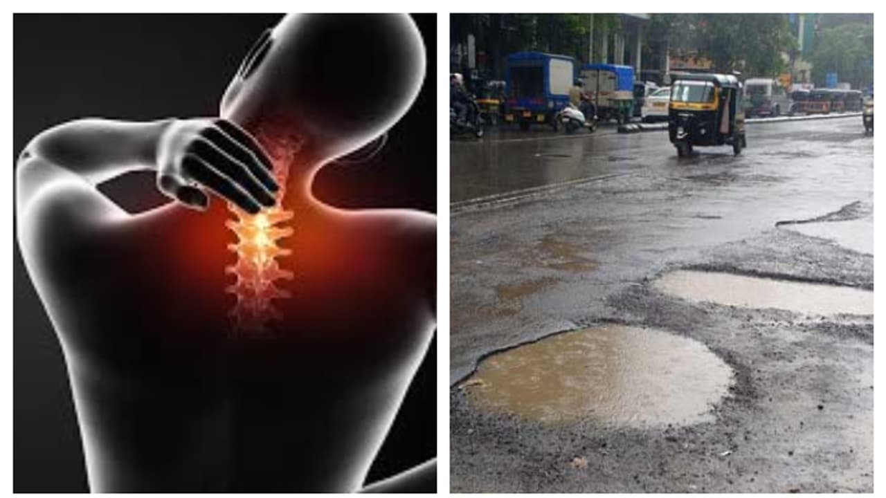 വിട്ടുമാറാത്ത കഴുത്തുവേദനയും പുറം വേദനയും, കാരണം റോഡ്; ബെംഗളൂരു നഗരസഭ 50 ലക്ഷം നഷ്ടപരിഹാരം നൽകണമെന്ന് യുവാവ് വിട്ടുമാറാത്ത കഴുത്തുവേദനയും പുറം വേദനയും, കാരണം റോഡ്; ബെംഗളൂരു നഗരസഭ 50 ലക്ഷം നഷ്ടപരിഹാരം നൽകണമെന്ന് യുവാവ്