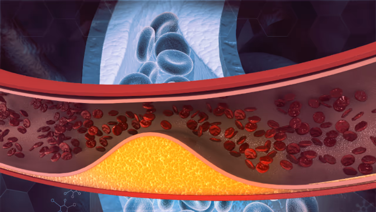 ഉയർന്ന കൊളസ്ട്രോൾ ഉള്ളവർ ഒഴിവാക്കേണ്ട ഒമ്പത് ഭക്ഷണങ്ങള് ഉയർന്ന കൊളസ്ട്രോൾ ഉള്ളവർ ഒഴിവാക്കേണ്ട ഒമ്പത് ഭക്ഷണങ്ങള്