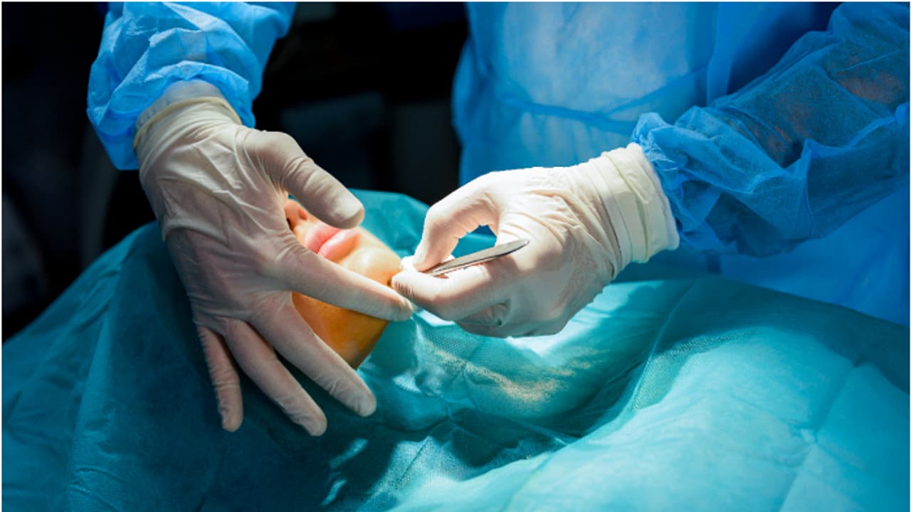 മിഡിൽ ഈസ്റ്റിലെ ആദ്യത്തെ സ്കിൻ ബാങ്ക് സ്ഥാപിക്കാനൊരുങ്ങി കുവൈത്ത് 