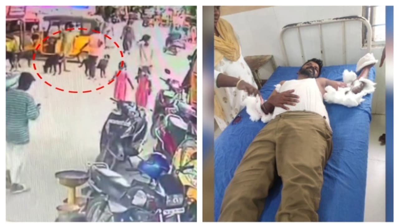 5 റോട്ട്വീലർ നായ്ക്കളുമായി റോഡിലിറങ്ങി 11കാരൻ; ഓട്ടോ ഡ്രൈവറെ ആക്രമിച്ചു, ഗുരുതര പരിക്ക്, ആശുപത്രിയിൽ 5 റോട്ട്വീലർ നായ്ക്കളുമായി റോഡിലിറങ്ങി 11കാരൻ; ഓട്ടോ ഡ്രൈവറെ ആക്രമിച്ചു, ഗുരുതര പരിക്ക്, ആശുപത്രിയിൽ