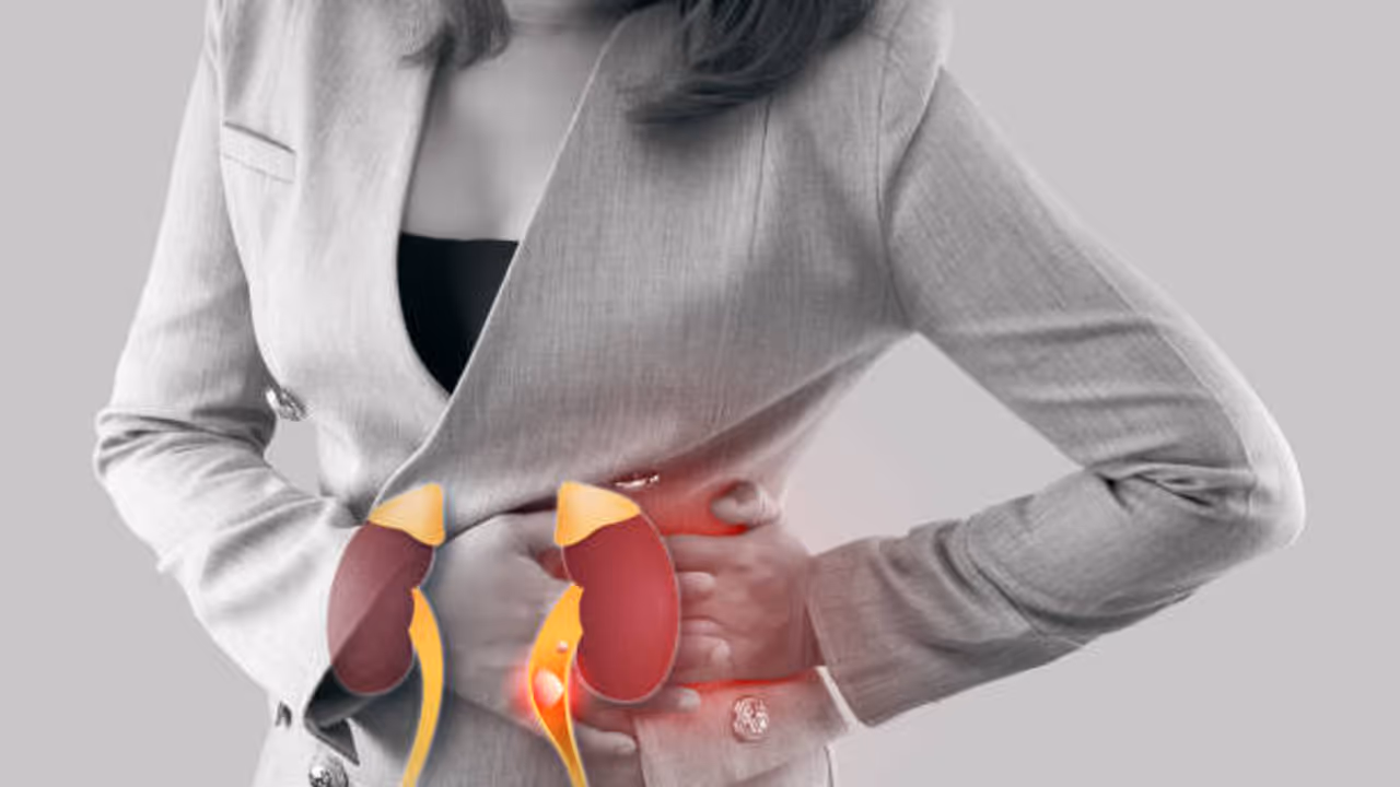 Kidney Stones and Treatment