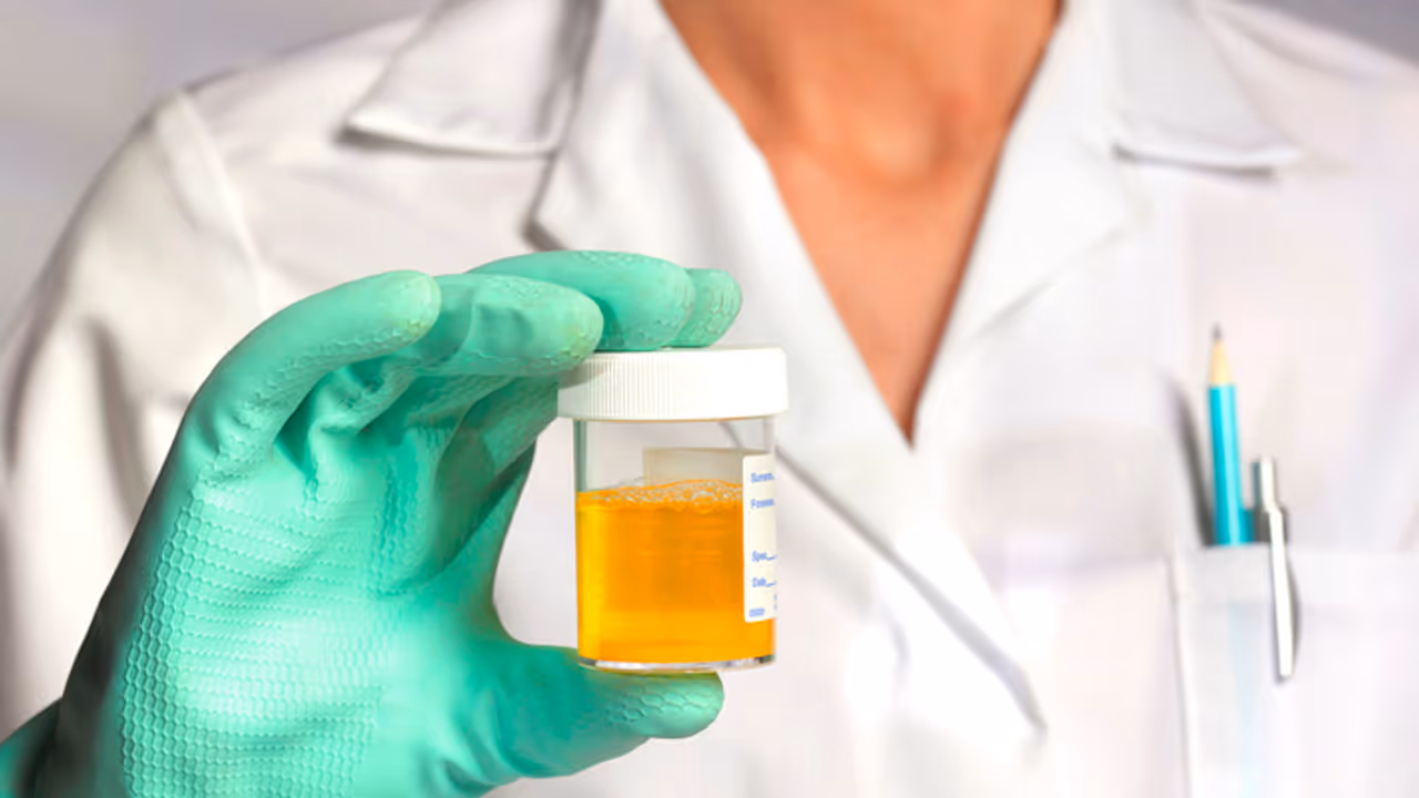 Scientists find a surprising use for urine