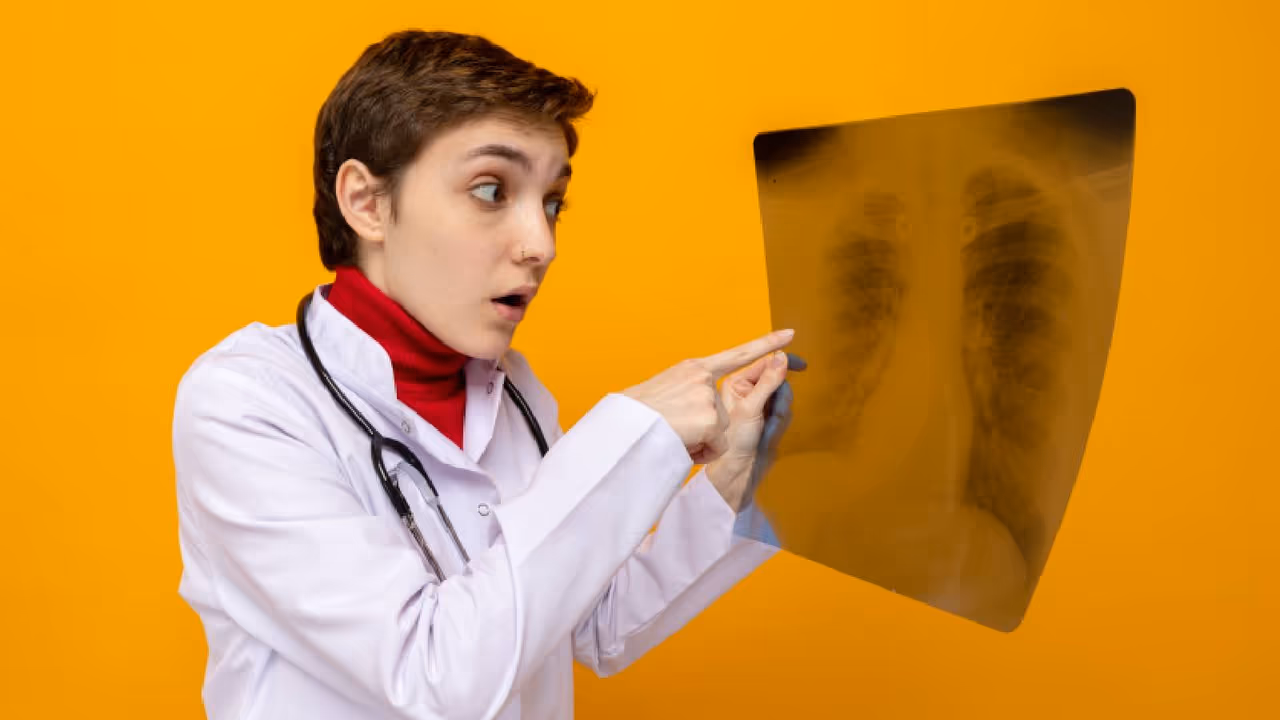 acute pneumonia acute pneumonia